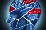 Research, Brain stroke, cooling treatment treats brain injuries and stroke says study, Head injury