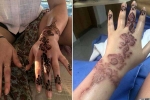 is brown henna safe, henna, henna tattoo cause aussie woman to almost lose her hand, Tattoo