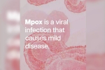 Health high alert, who on mpox, mpox emergency again, Mpox