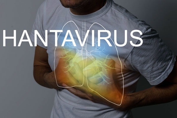 Hantavirus requires Prolonged close contact for Transmission Hantavirus requires Prolonged close contact for Transmission